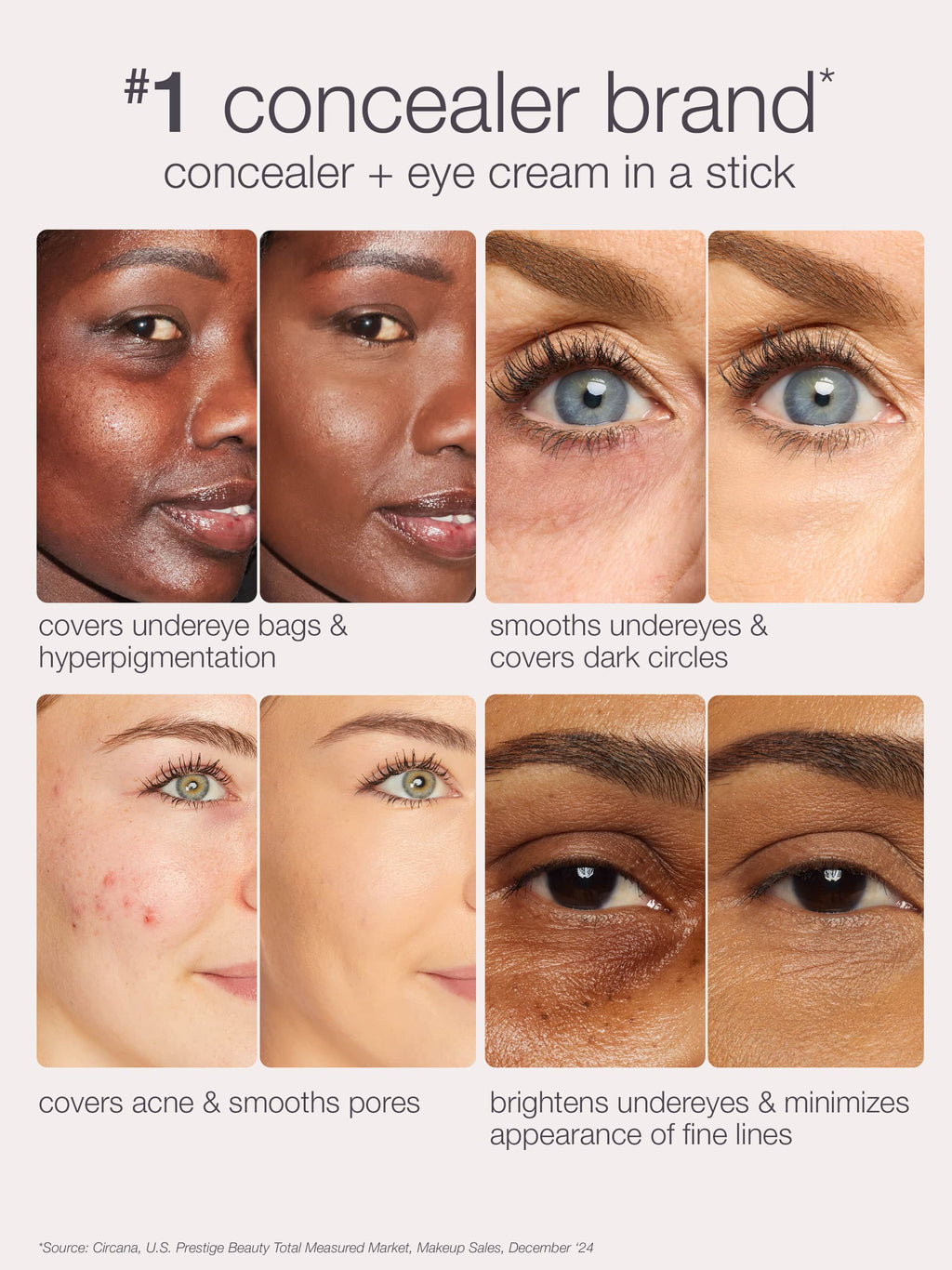 Advertisement for a concealer brand showing before and after effects on skin.