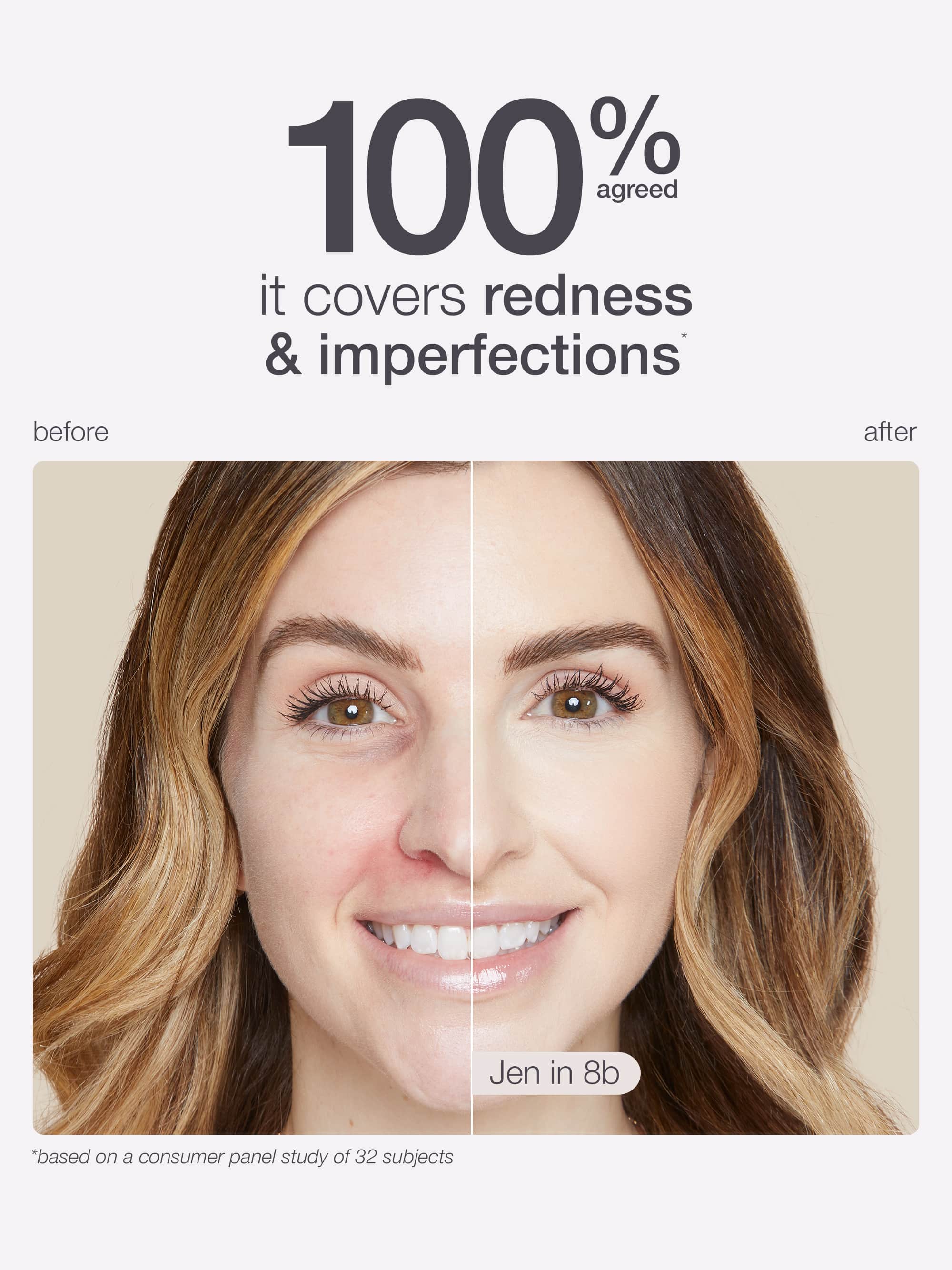 Before and after comparison of a woman's face with text indicating product effectiveness on redness and imperfections.