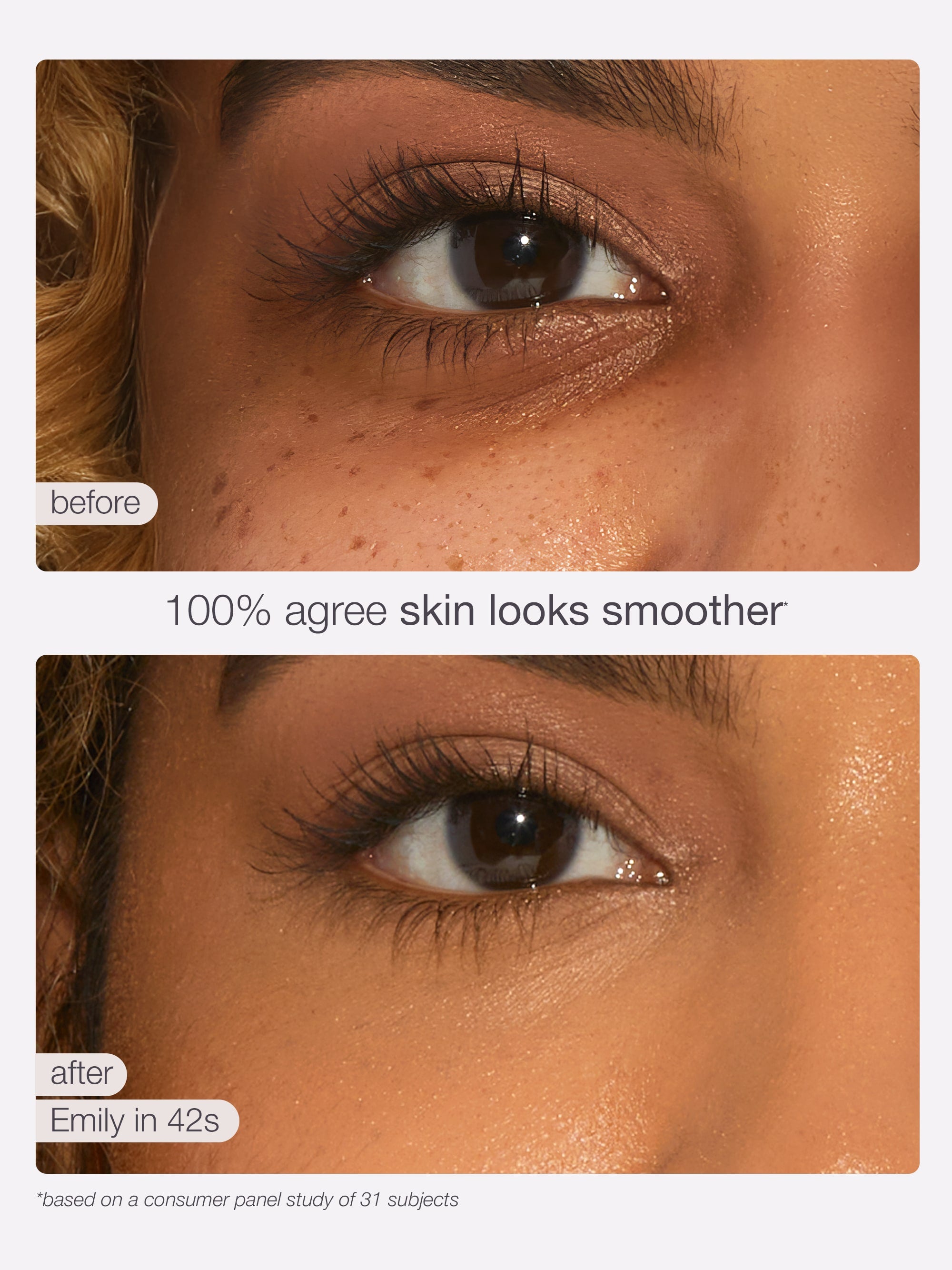 Before and after comparison of skin texture on a person's face with text indicating smoother skin.