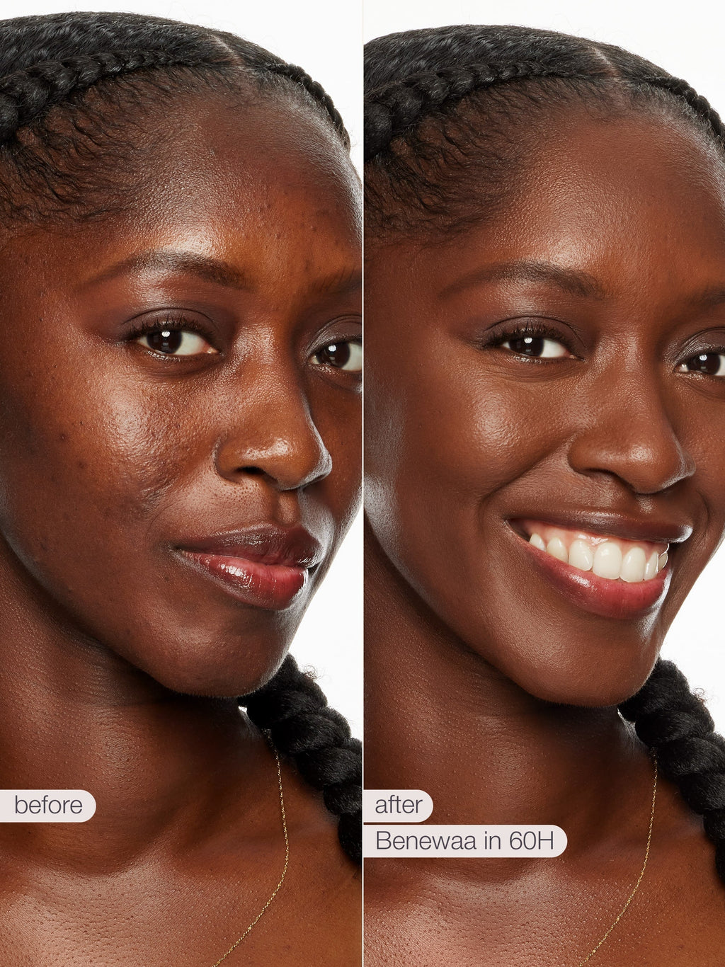 Before and after comparison of a woman's face with Benewaa skincare tarte shape tape concealer product.