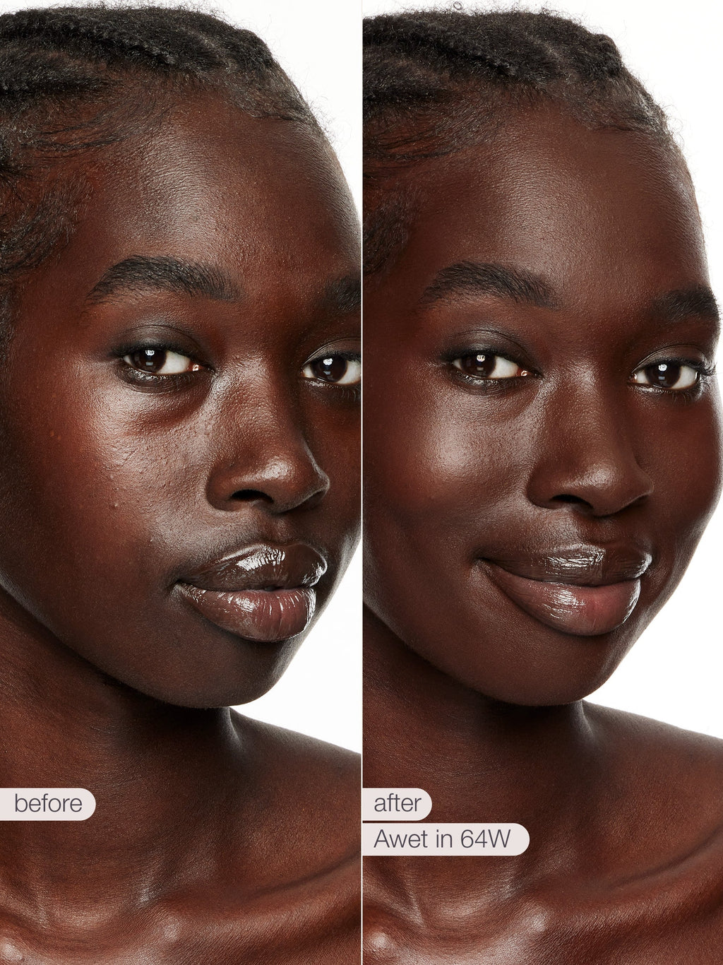 Before and after comparison of a woman's face with text indicating a treatment or product name.
