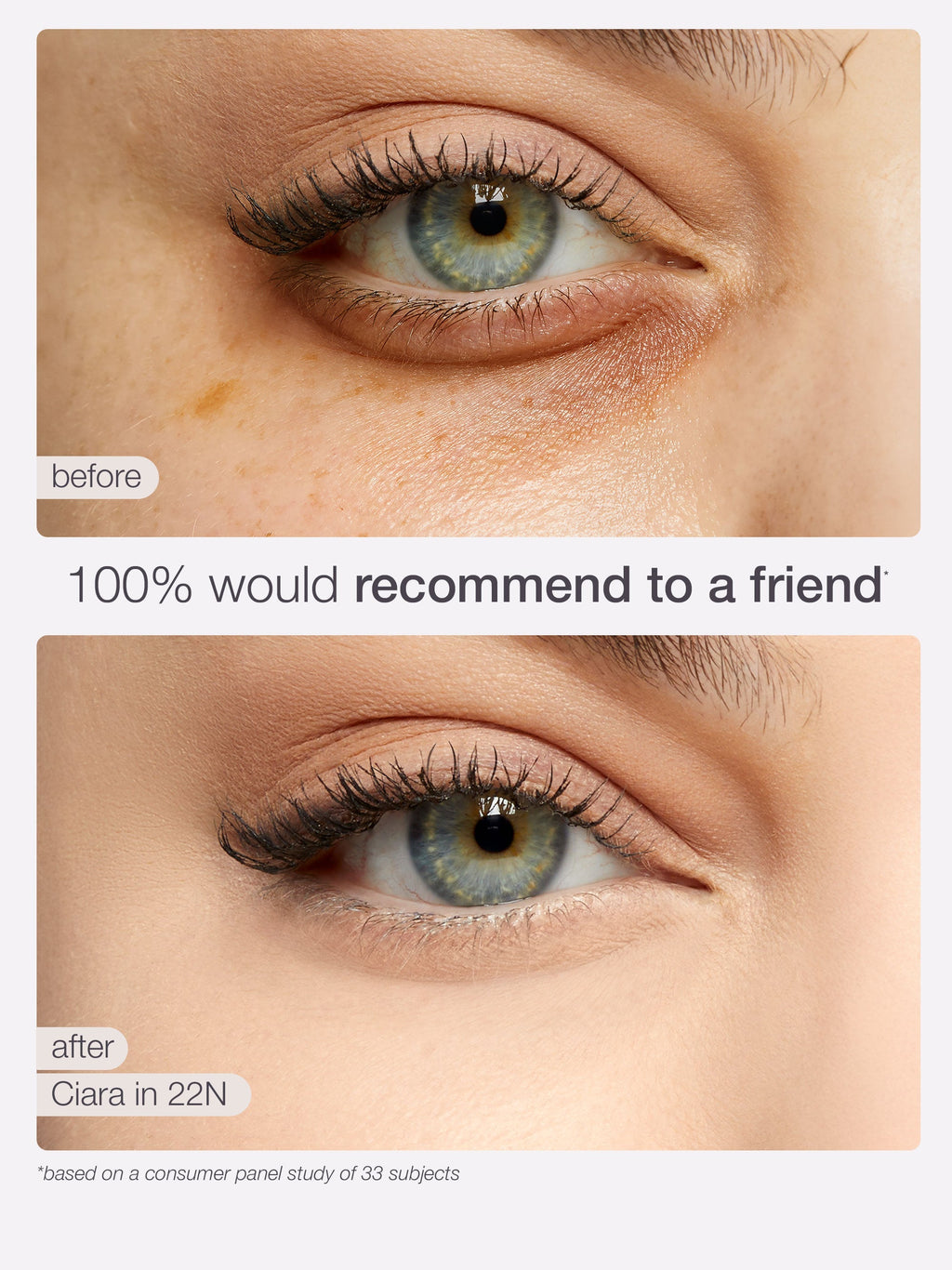 Before and after comparison of a eye treatment showing a visible improvement.