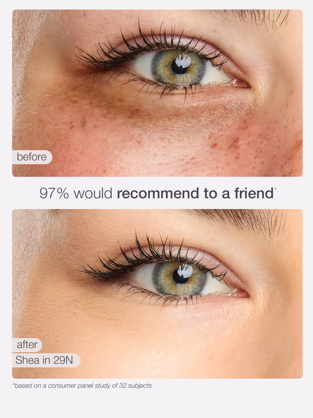 Before and after comparison of a eye with skincare product application, showing a positive recommendation rate.