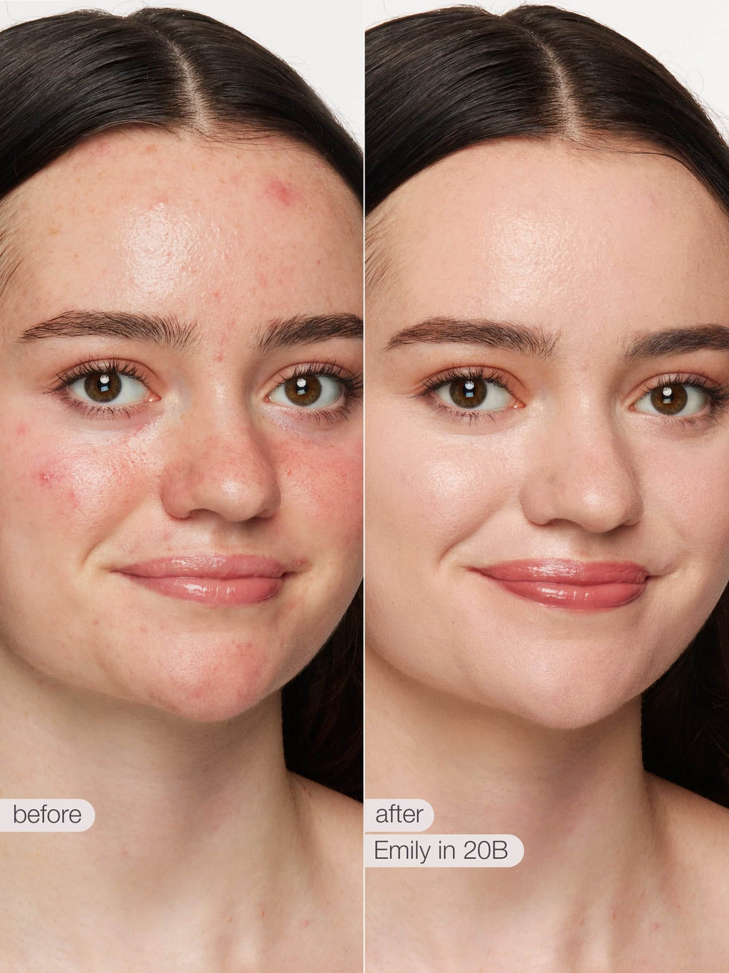 Before and after comparison of a woman's face with text labels 'before' and 'after' on a plain background.