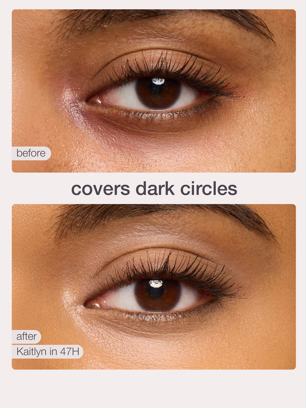Before and after comparison of an eye with dark circles, showing a product application.