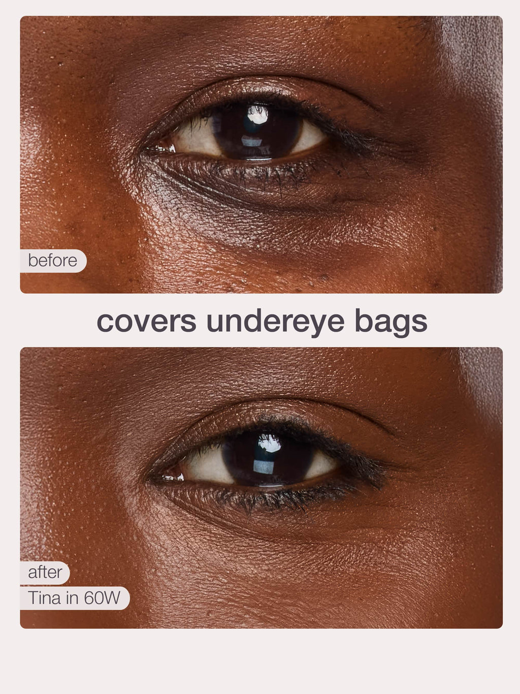 Before and after comparison of under-eye bags with product name 'Tina' and wavelength '60W'.